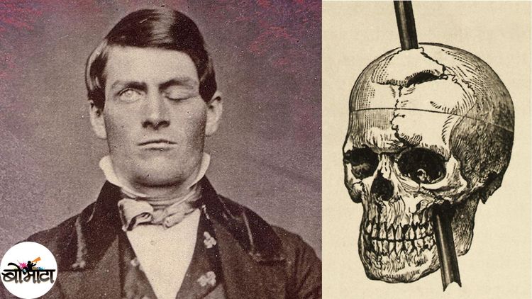 आपला मेंदू काय काम करतो याचा शोध या विचित्र अपघातामुळं लागला..