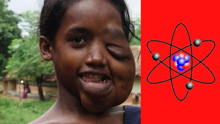 जादूगुडातील किरणोत्सर्गाचे बळी...वाचा भारताच्या युरेनियम खाणीचे काळे सत्य !!