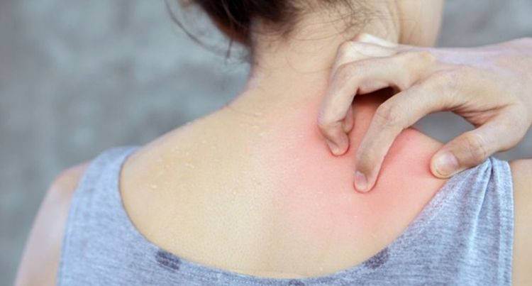 त्वचेचे रोग: