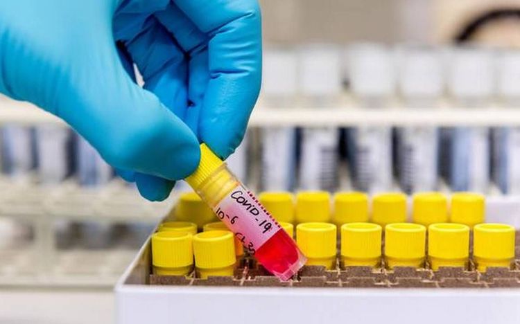 कोरोनाचे व्हॅक्सीन तयार करण्यासाठी तंबाखू आणि गांजाच्या पानांचा वापर का होतोय? पूर्ण माहिती वाचा !!