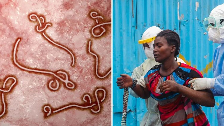 इबोला काय आहे? वाचा १९७६ साली सापडलेल्या या विषाणूचा आजवरचा प्रवास !!