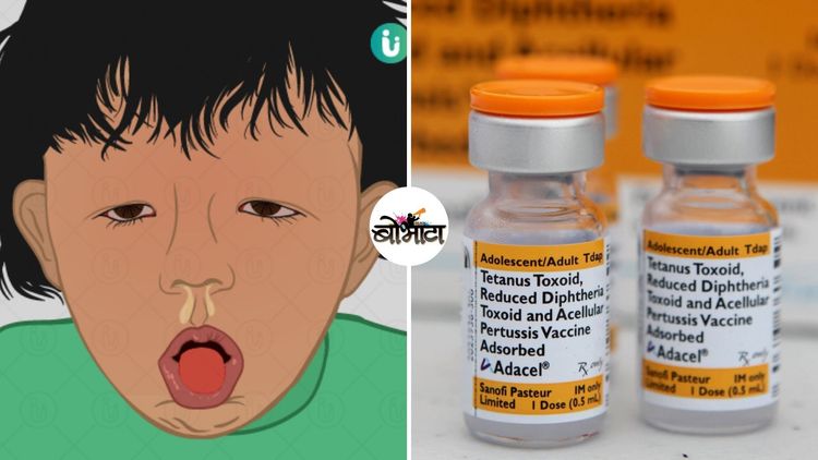 व्हॅक्सिनमुळे जीवावर बेतण्यापासून ते अनेक मुलांना जीवनदान मिळेपर्यंत....हा आहे डांग्या खोकल्याच्या व्हॅक्सिनचा इतिहास!!