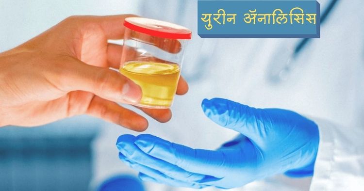 मूत्रतपासणी (रूटीन युरीन अ‍ॅनालिसिस) : का करावी, काय खबरदारी घ्यावी, कधी केली जाते आणि तीमधून काय समजते? सर्व उत्तरे एकाच ठिकाणी!!