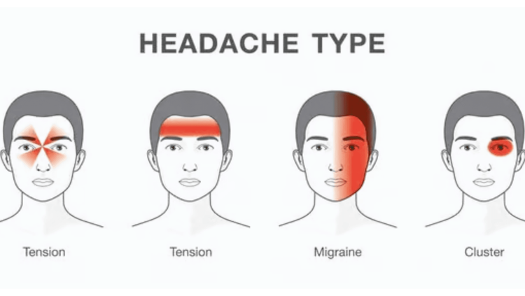 अर्धशिशिची लक्षणे 