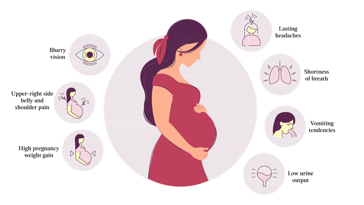 काय आहे प्री एकलंपशिया