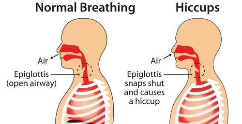 उचकी का लागते ?