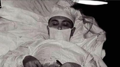 स्वतःच स्वतःच्या अपेंडिक्सचं ऑपरेशन करणारा डॉक्टर !!