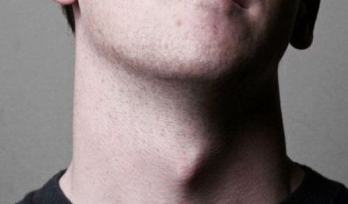 प्युबरफोनिया कोणाला होतो?