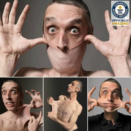 ५. गेरी टर्नरने ताणलेल्या त्वचेचा विक्रम केला आहे.