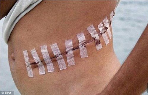 ४. शरीरात लपवून स्मगलिंग करणं